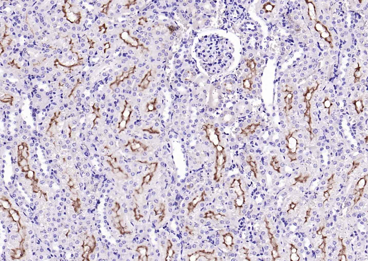 14 - Transmembrane protein 30A Rabbit pAb AP56322
