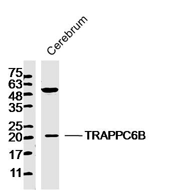 1 - TRAPPC6B Rabbit pAb AP56326