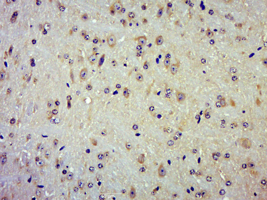 14 - TRAPPCL2 Rabbit pAb AP56328