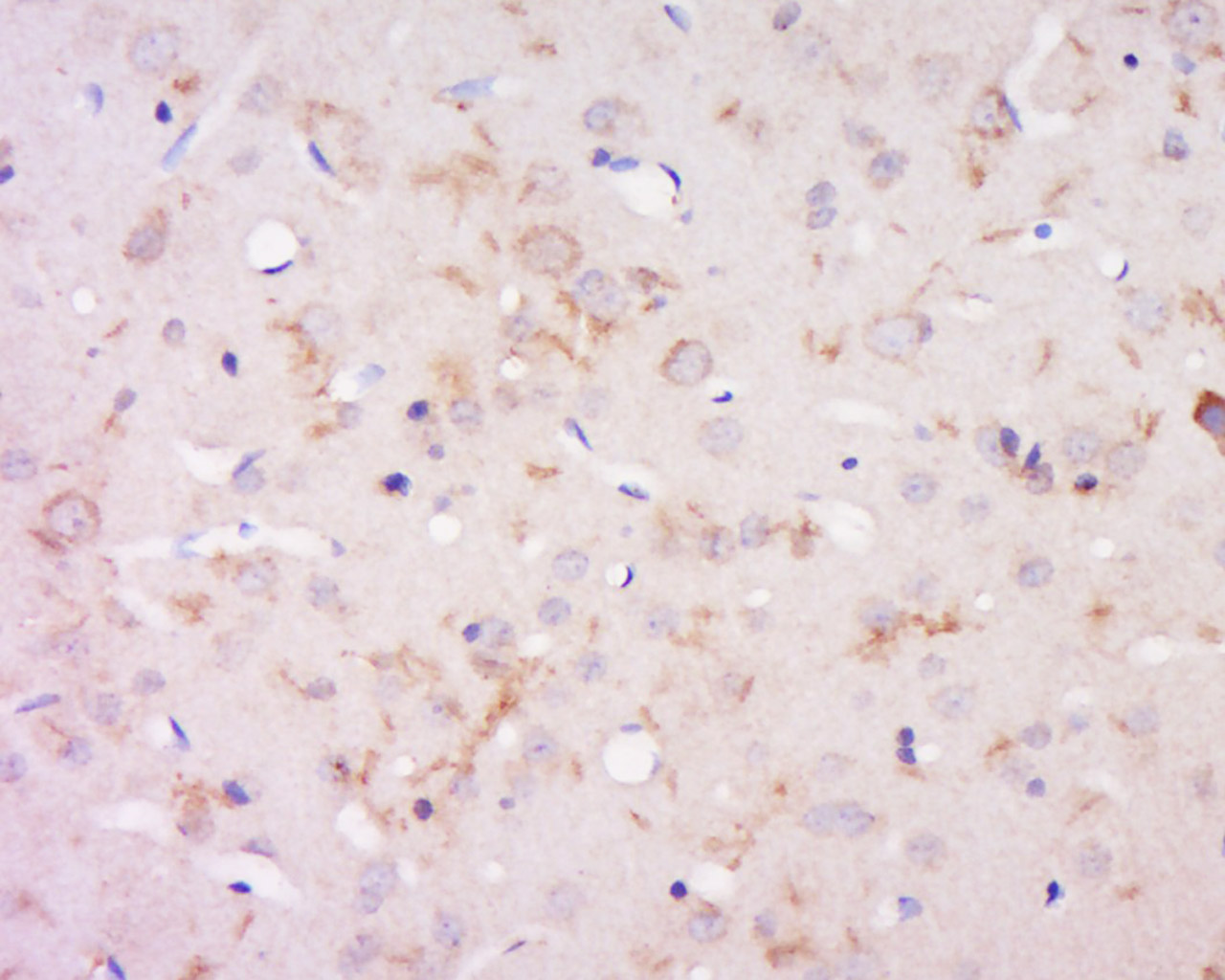 14 - DILP3 Rabbit pAb AP56330