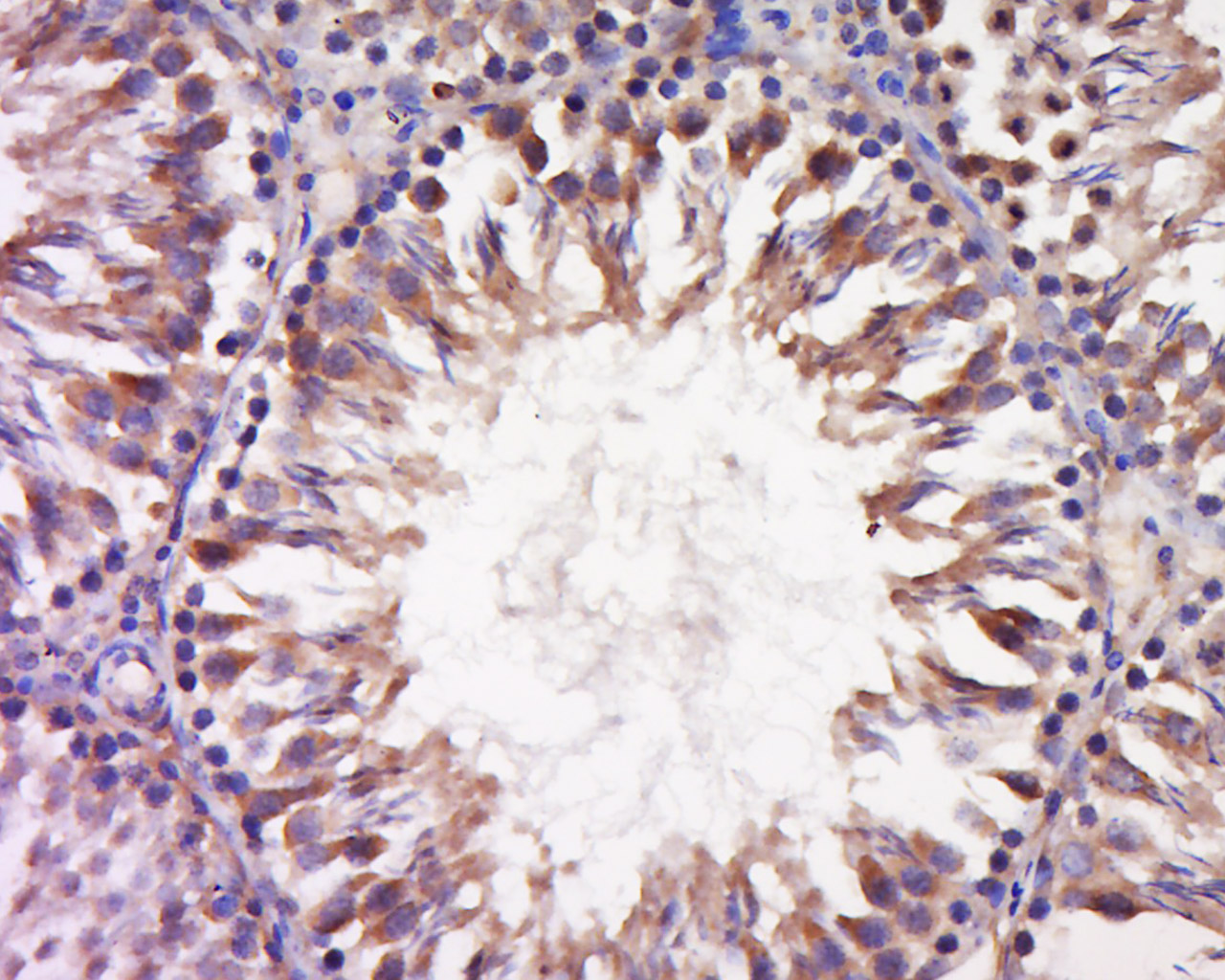 14 - INSL6 Rabbit pAb AP56355