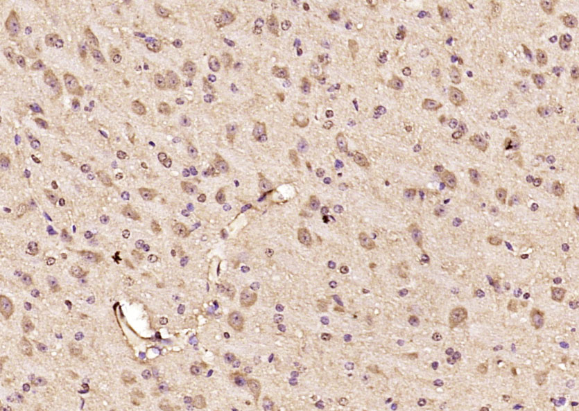 14 - TRBP Rabbit pAb AP56368