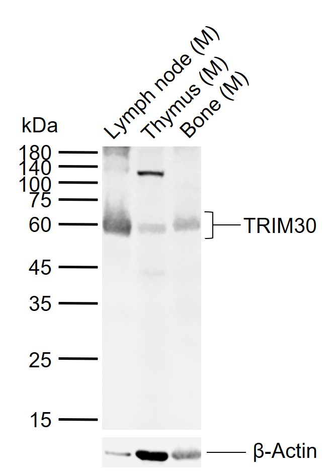 1 - TRIM30 Rabbit pAb AP56377