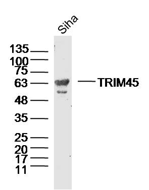 1 - TRIM45 Rabbit pAb AP56381
