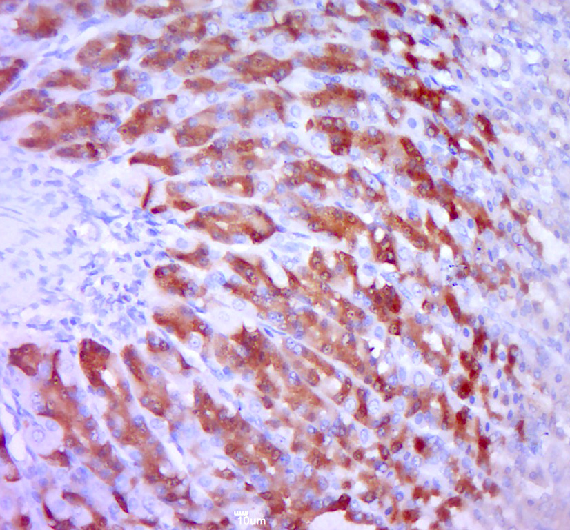 14 - KLC3 Rabbit pAb AP56386