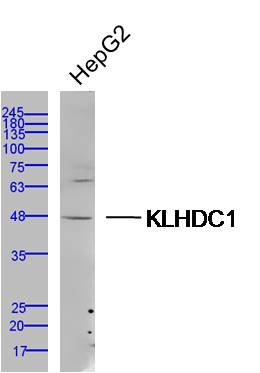 1 - KLHDC1 Rabbit pAb AP56389