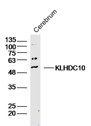 1 - KLHDC10 Rabbit pAb AP56390