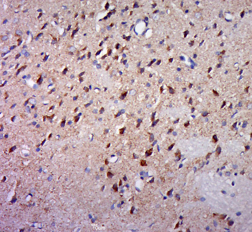 14 - KLHDC10 Rabbit pAb AP56390