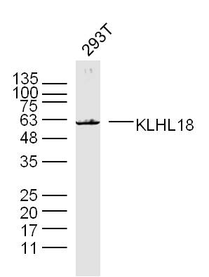 1 - KLHL18 Rabbit pAb AP56395