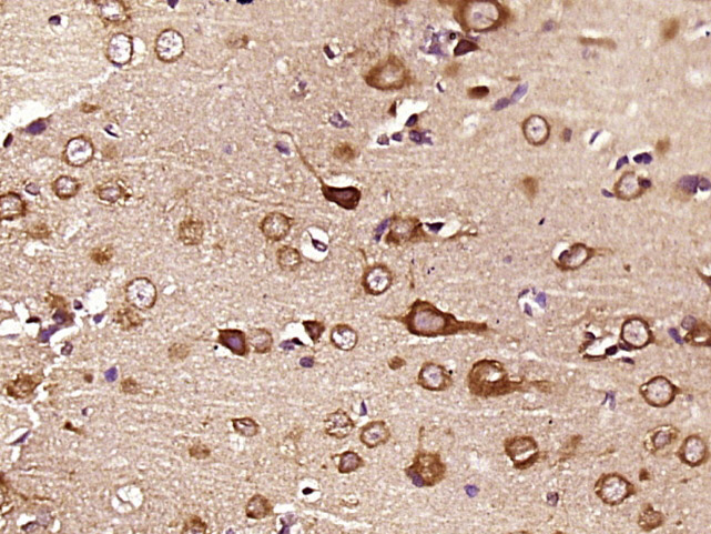 14 - KLHL18 Rabbit pAb AP56395