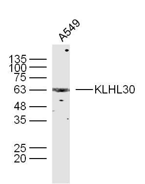 1 - KLHL30 Rabbit pAb AP56396