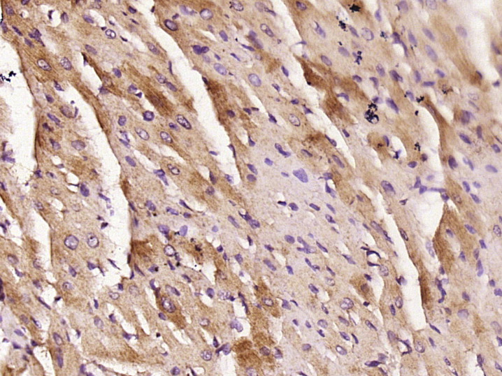 14 - KLHL38 Rabbit pAb AP56398