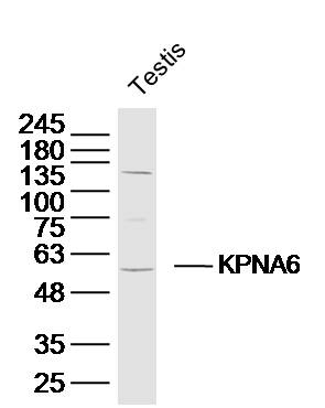 1 - KPNA6 Rabbit pAb AP56410