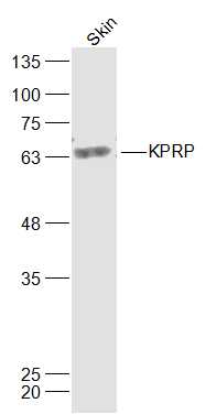 1 - KPRP Rabbit pAb AP56411