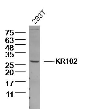 1 - KR102 Rabbit pAb AP56412