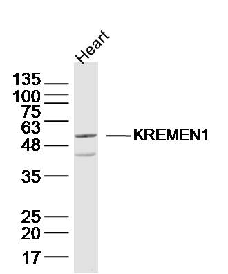 1 - KREMEN1 Rabbit pAb AP56414