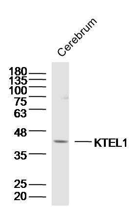 1 - KTEL1 Rabbit pAb AP56443