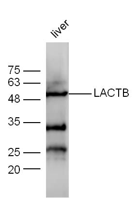 1 - LACTB Rabbit pAb AP56451
