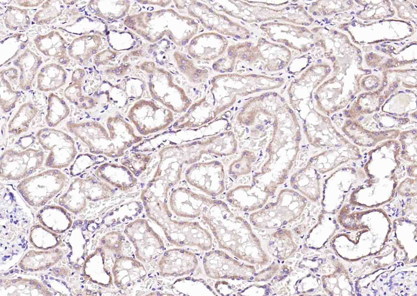 14 - LACTB Rabbit pAb AP56451