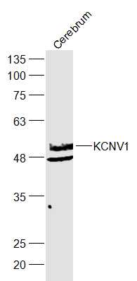 1 - KCNV1 Rabbit pAb AP56467