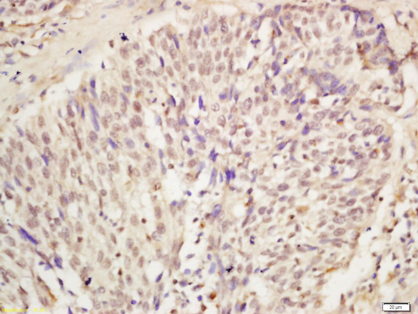 14 - KDM5A Rabbit pAb AP56474