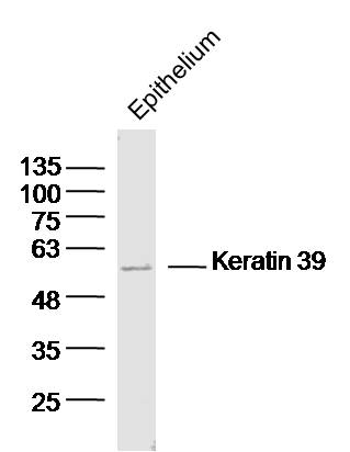 1 - Keratin 39 Rabbit pAb AP56475