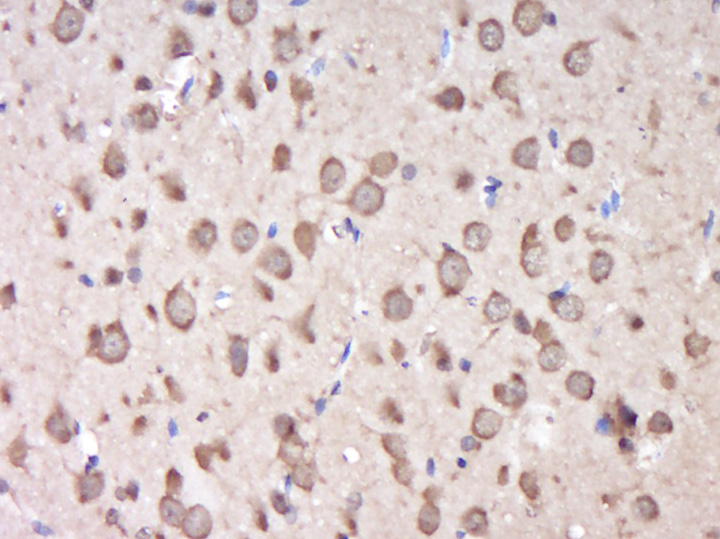 14 - KIAA0319L Rabbit pAb AP56484