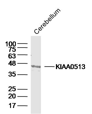 1 - KIAA0513 Rabbit pAb AP56489