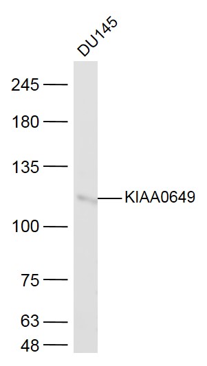 1 - KIAA0649 Rabbit pAb AP56491