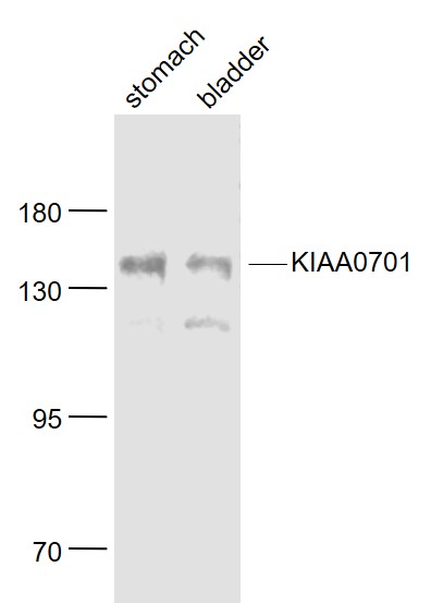1 - KIAA0701 Rabbit pAb AP56493