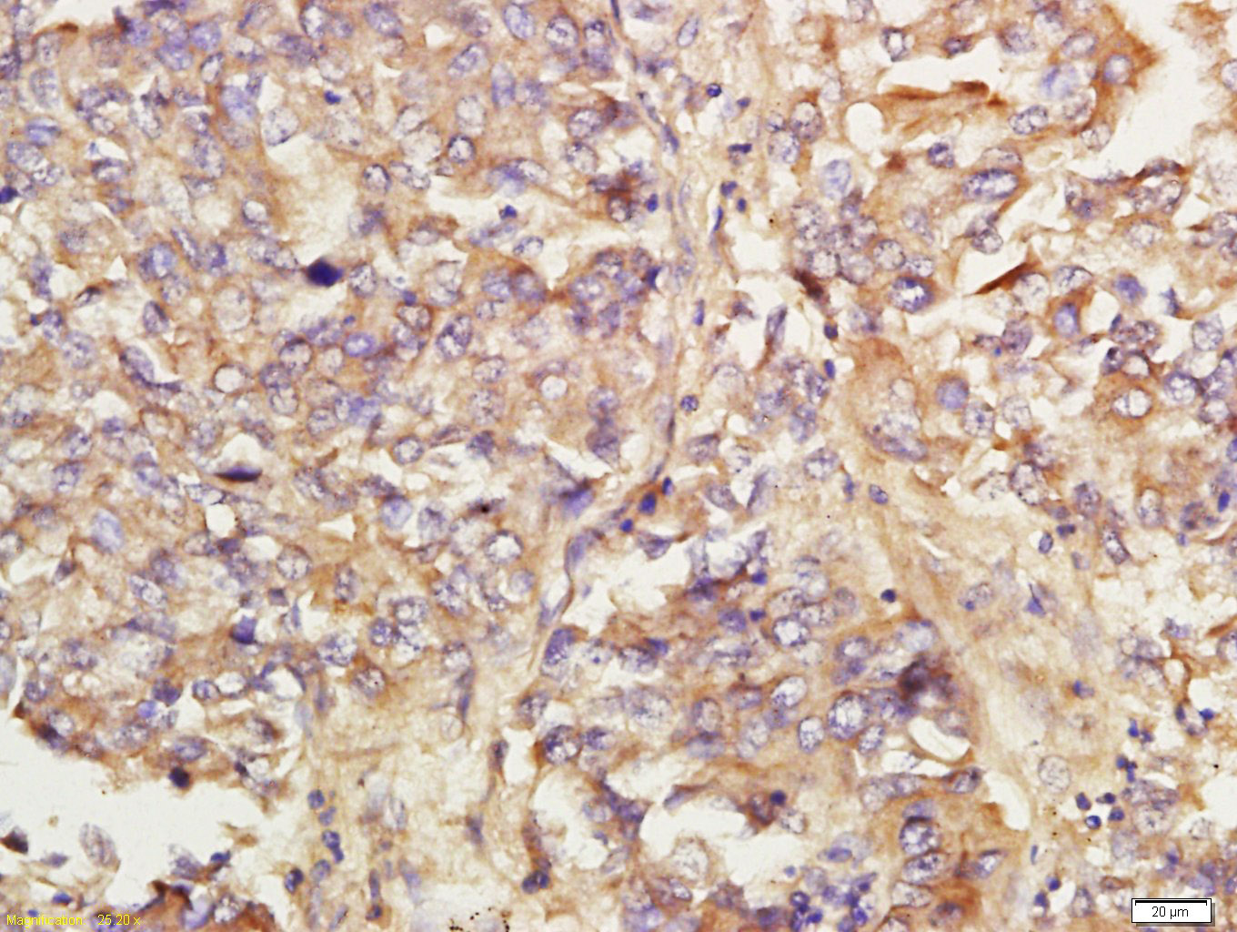 14 - KIAA0701 Rabbit pAb AP56493