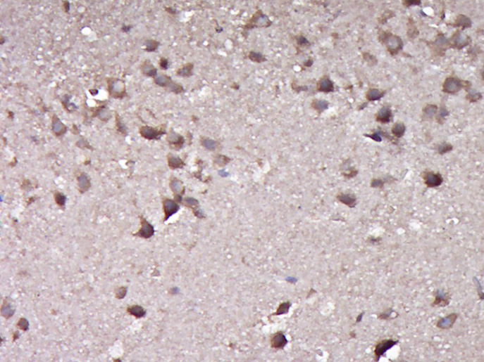 14 - KIAA0859 Rabbit pAb AP56495