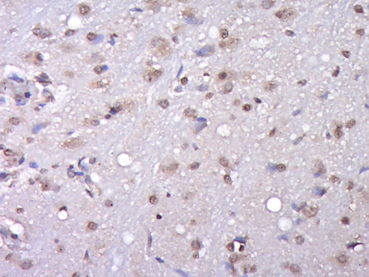 14 - KIAA1107 Rabbit pAb AP56500