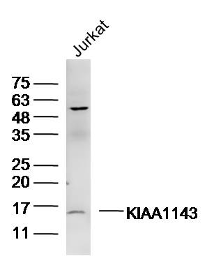 1 - KIAA1143 Rabbit pAb AP56502