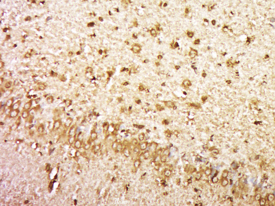 14 - KIAA1161 Rabbit pAb AP56503