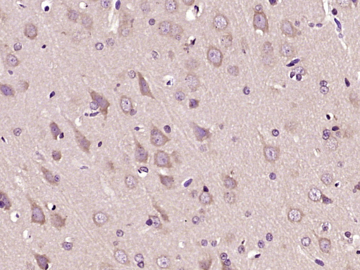 14 - KIAA1434 Rabbit pAb AP56509