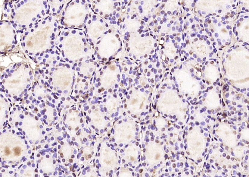 14 - KIAA1456 Rabbit pAb AP56510