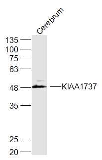 1 - KIAA1737 Rabbit pAb AP56520