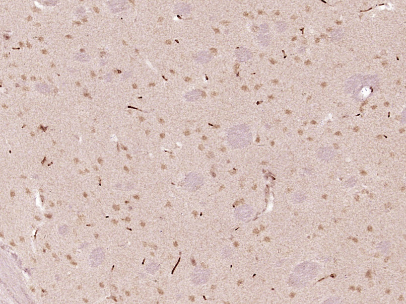 14 - KIAA1755 Rabbit pAb AP56522