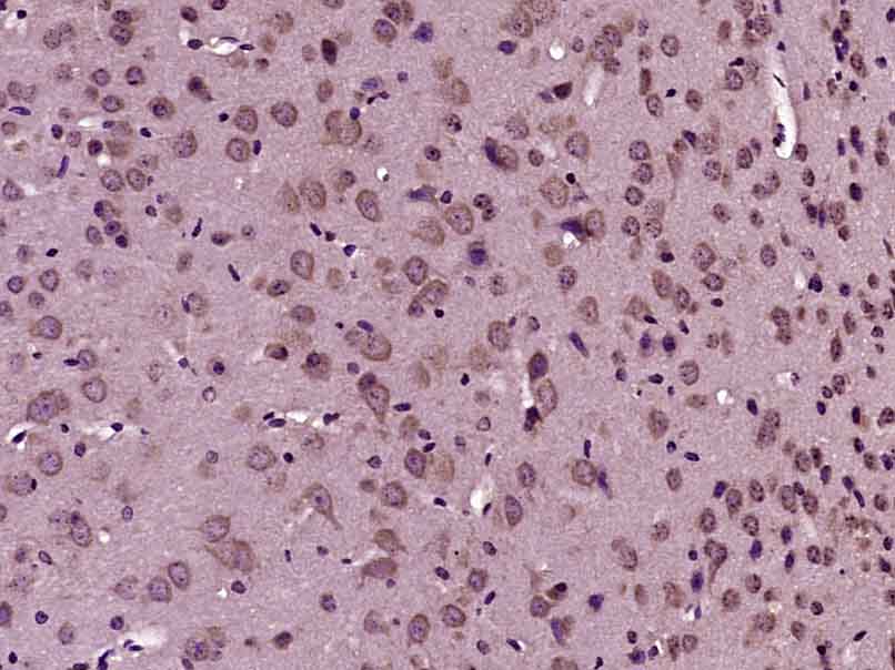14 - KIF21A Rabbit pAb AP56533