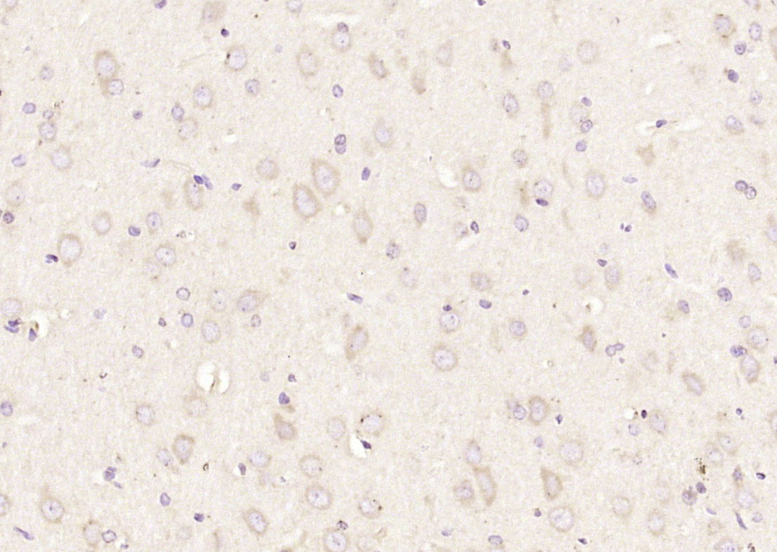 14 - KIF2A Rabbit pAb AP56537