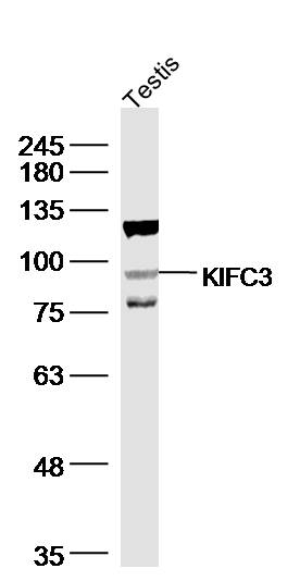 1 - KIFC3 Rabbit pAb AP56540