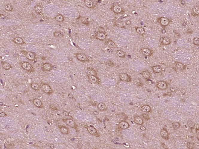 14 - KIF5C Rabbit pAb AP56541
