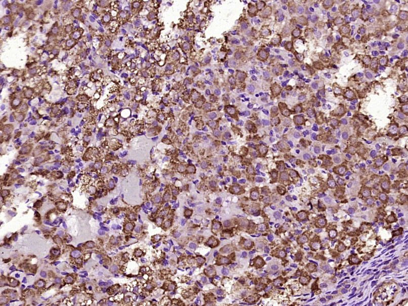 14 - Kinectin 1 Rabbit pAb AP56544