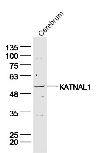 1 - KATNAL1 Rabbit pAb AP56548