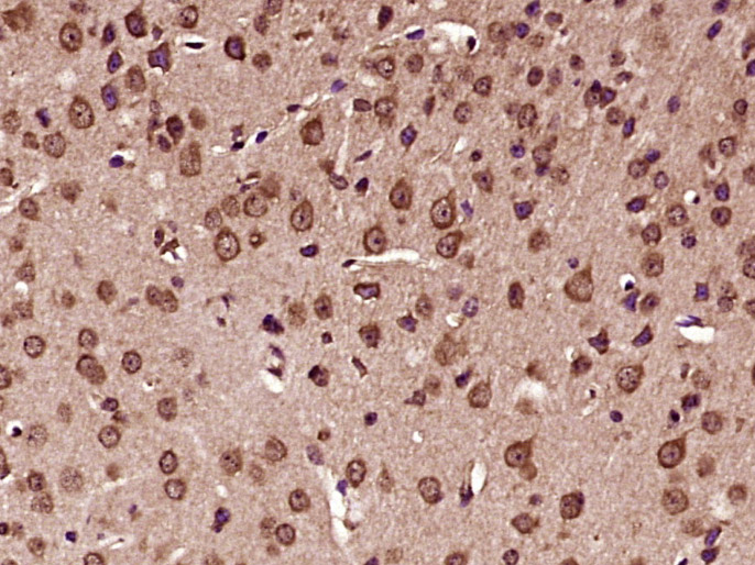 14 - KATNAL2 Rabbit pAb AP56549