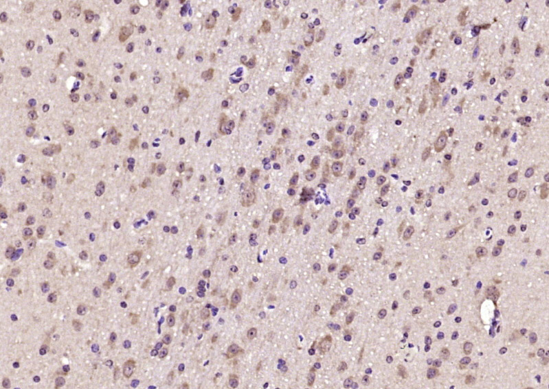 14 - KBTBD11 Rabbit pAb AP56552