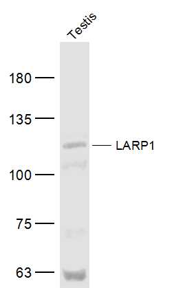 1 - LARP1 Rabbit pAb AP56558