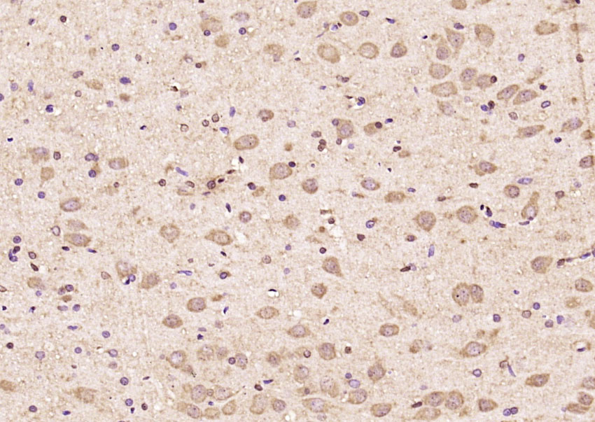 14 - PCDA6 Rabbit pAb AP56566