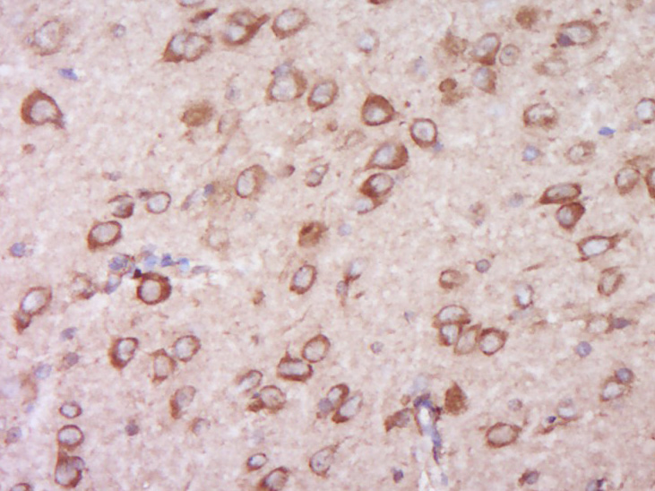 14 - TRIP11/TRIP230 Rabbit pAb AP56568